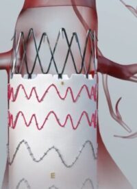 Artivion E-tegra customer facing_approved