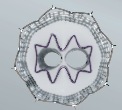 Artivion E-tegra customer facing_approved