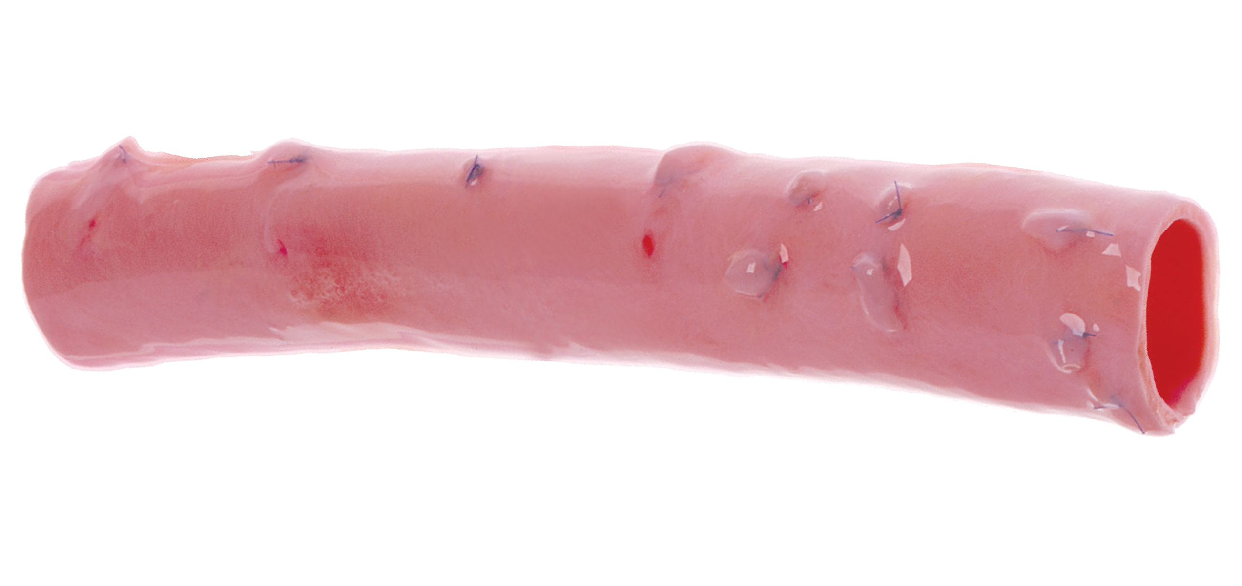 US-CryoGraft-DTA-Design-Features-2544x1200