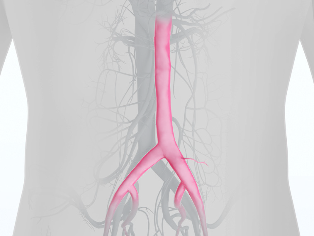 US_Aorta_Iiacc-Product-Highlights-1272x954