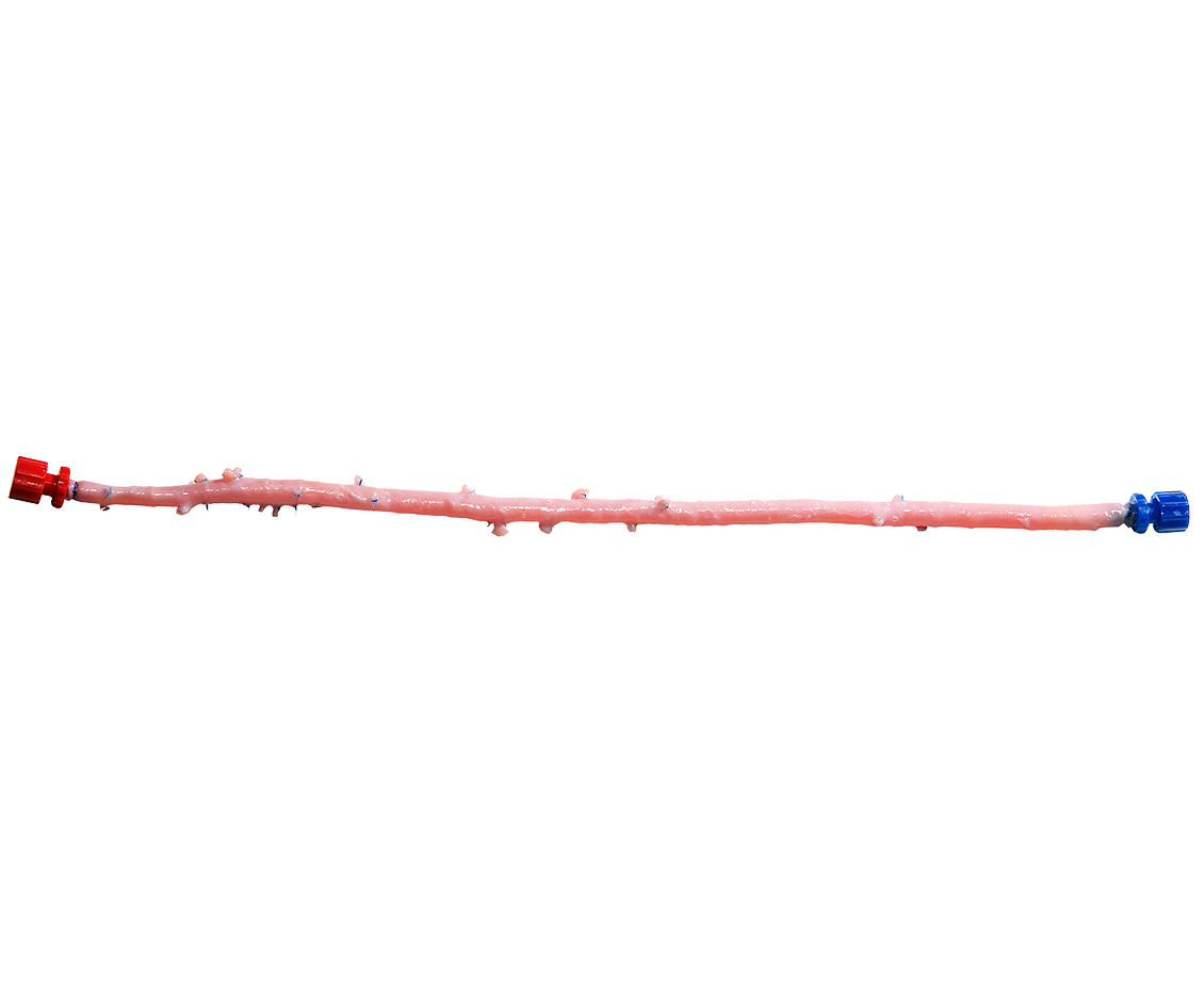 US_Fermoral_Artery-Hero-1130x942