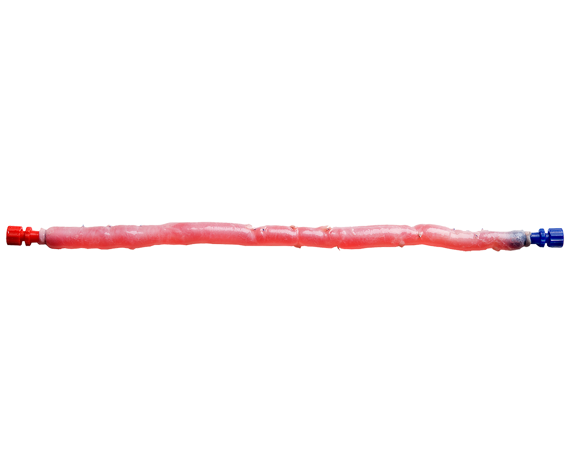 US-CryoVein-Femoral-Hero-1130x942