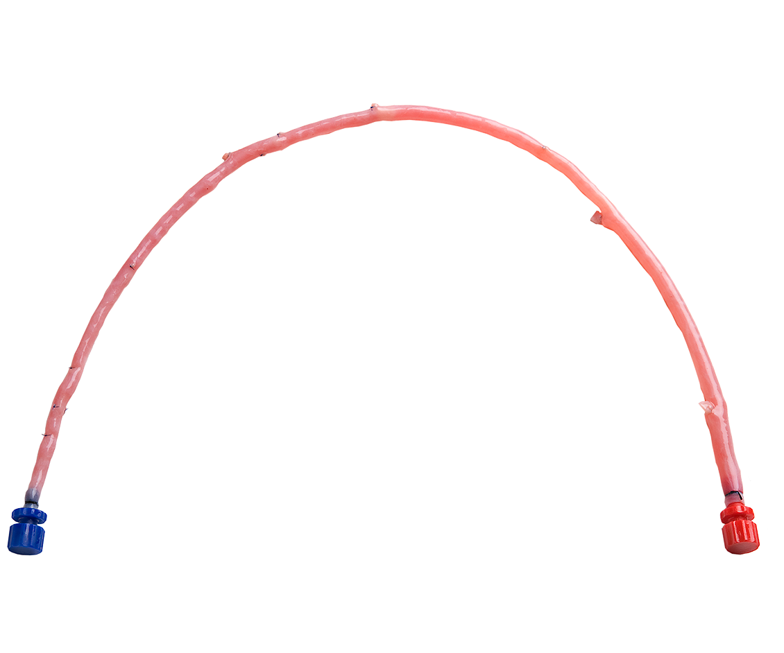 US-Saphenous-Vein-Hero-1130x942