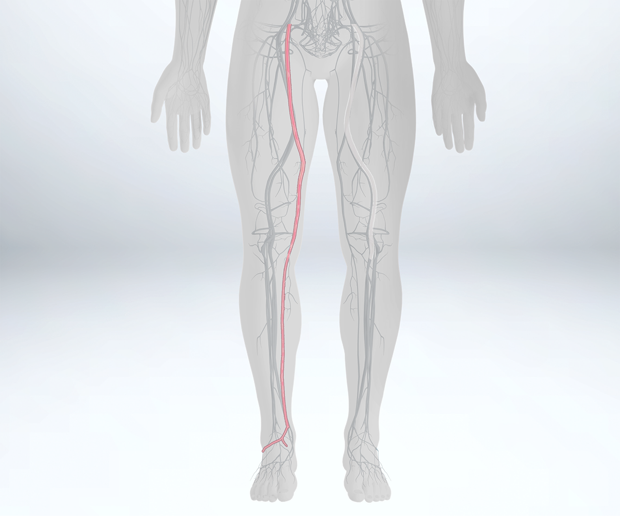 US-Saphenous-Vein-Product-Highlights