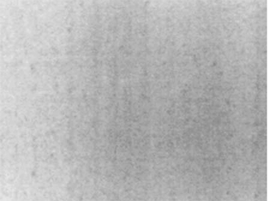 US_On-X_Mitral-2-Column-2a