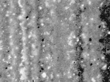 US_On-X_Mitral-2-Column-2b