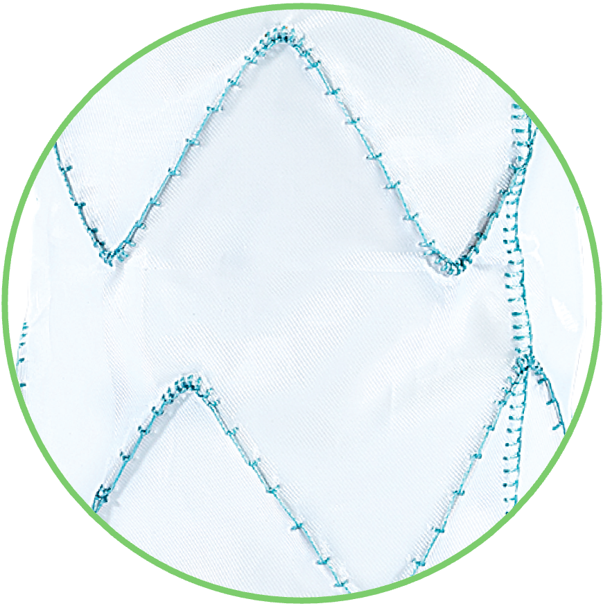 Artivex Stent Design