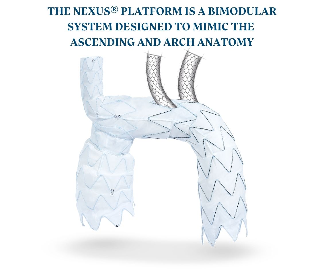 THE NEXUS® PLATFORM IS A BIMODULAR SYSTEM DESIGNED TO MIMIC THE ASCENDING AND ARCH ANATOMY